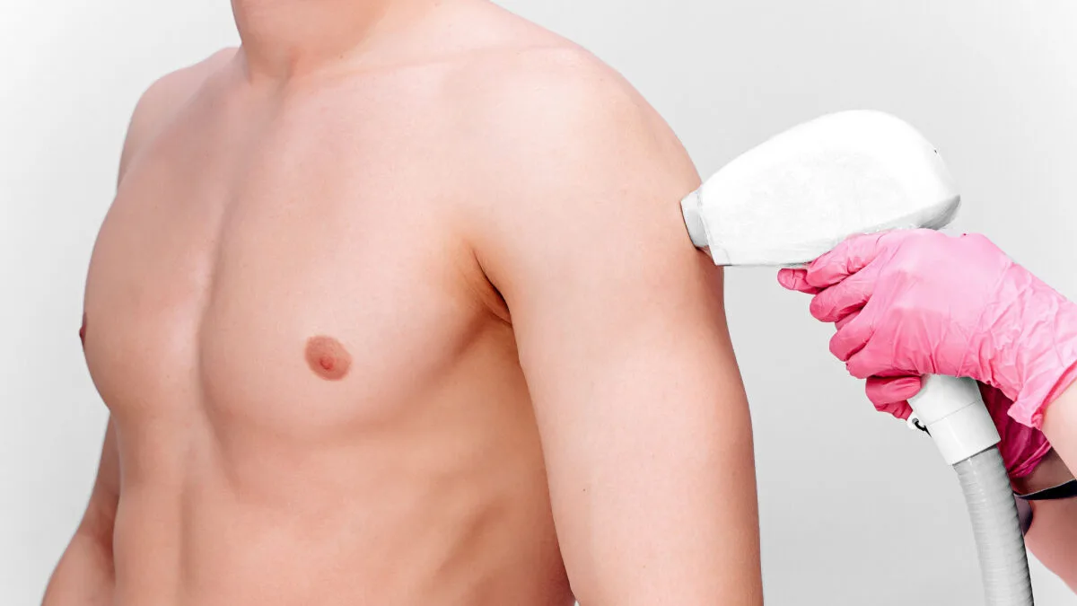 depilazione uomo laser