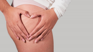 Smagliature dopo Dieta o Allenamento