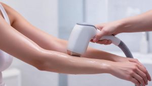 Peli Incarniti: Perché il Laser È la Soluzione